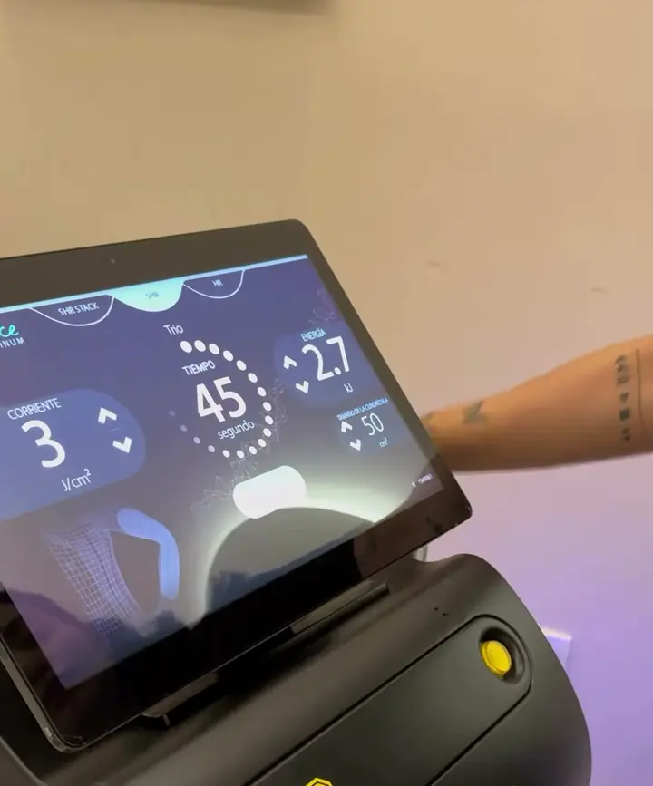 Pantalla táctil del láser Soprano Ice Platinum.